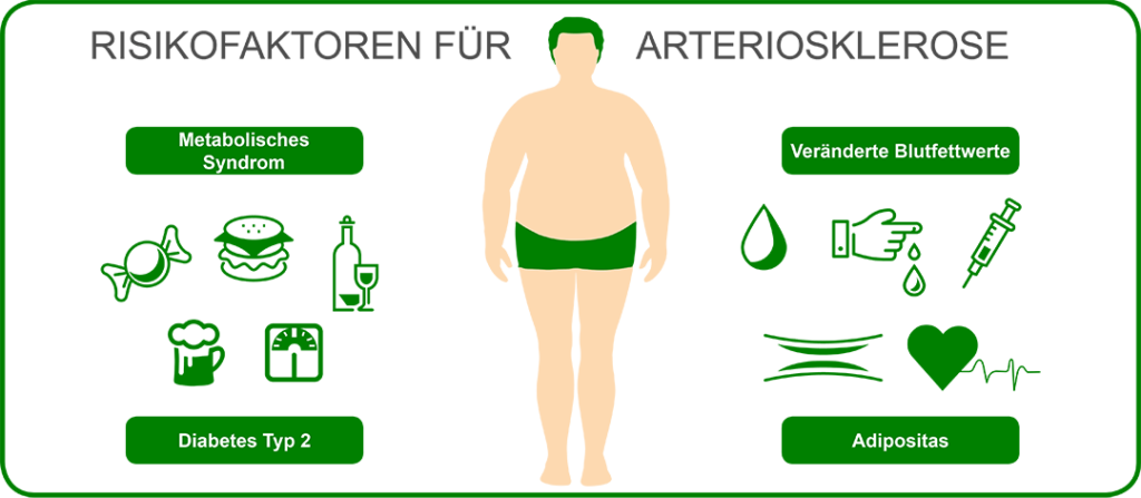 Grafik zu Risikofaktoren für Arteriosklerose